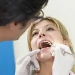dental cleaning
