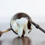 GENERAL DENTISTRY SANTA CLARITA