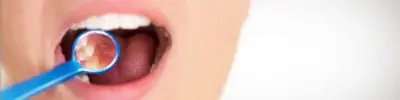 gum recession