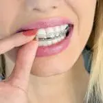 A person touching her braces
