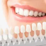 Perfect smile achieved using durable dental crowns at Valencia, CA clinic.