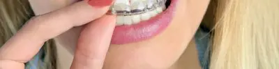 A person touching her braces