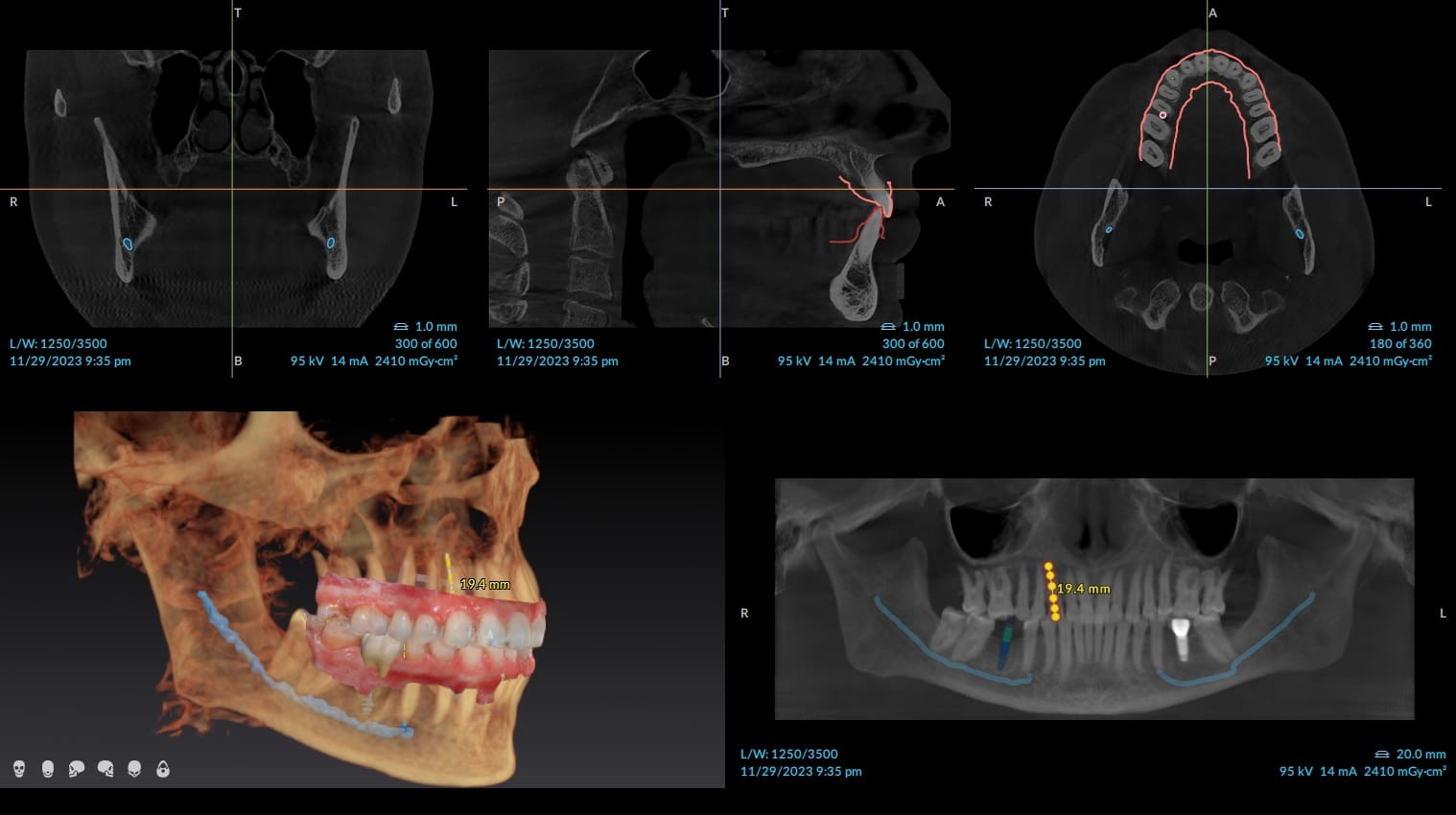 cbct example