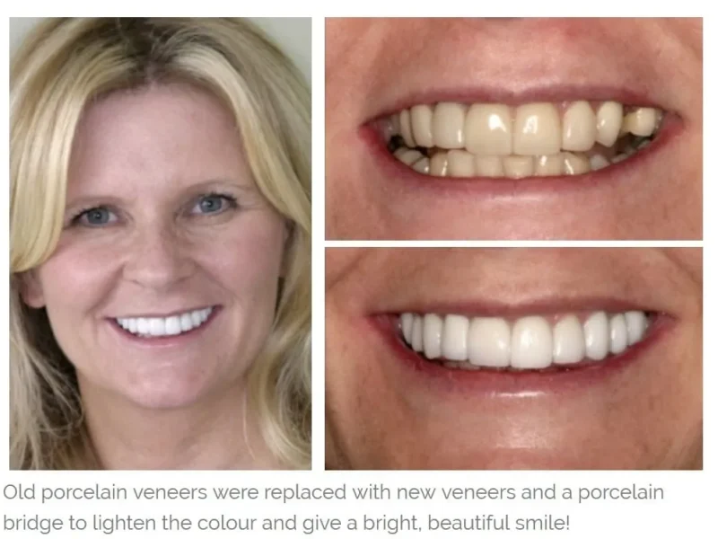 A blond-haired woman showing her teeth