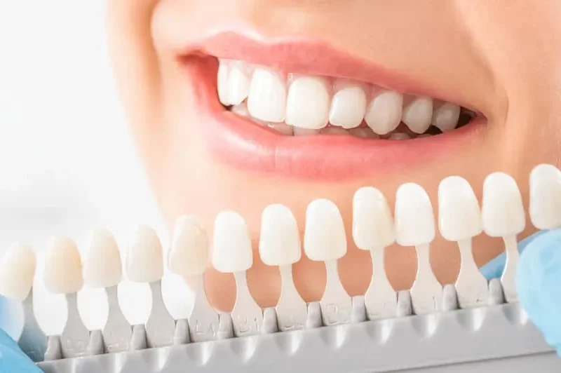 Perfect smile achieved using durable dental crowns at Valencia, CA clinic.