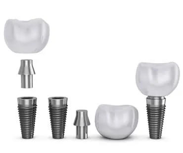 dental implants